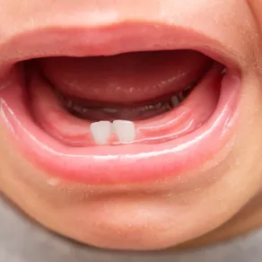 صورة لأسنان طفل