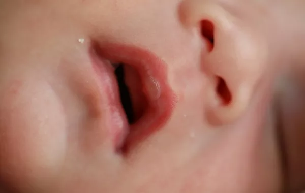 صورة لرضيع يفتح فمه عند النوم