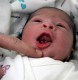 ولادة طفل مع أسنان