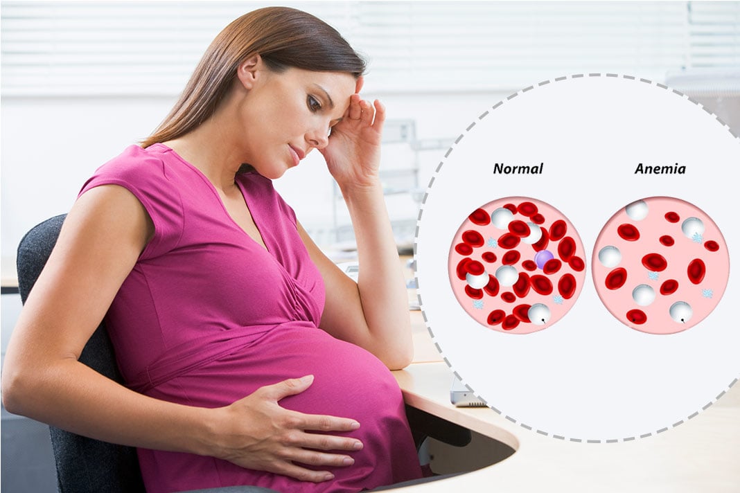 suffers-from-anaemia-during-pregnancy.jpg