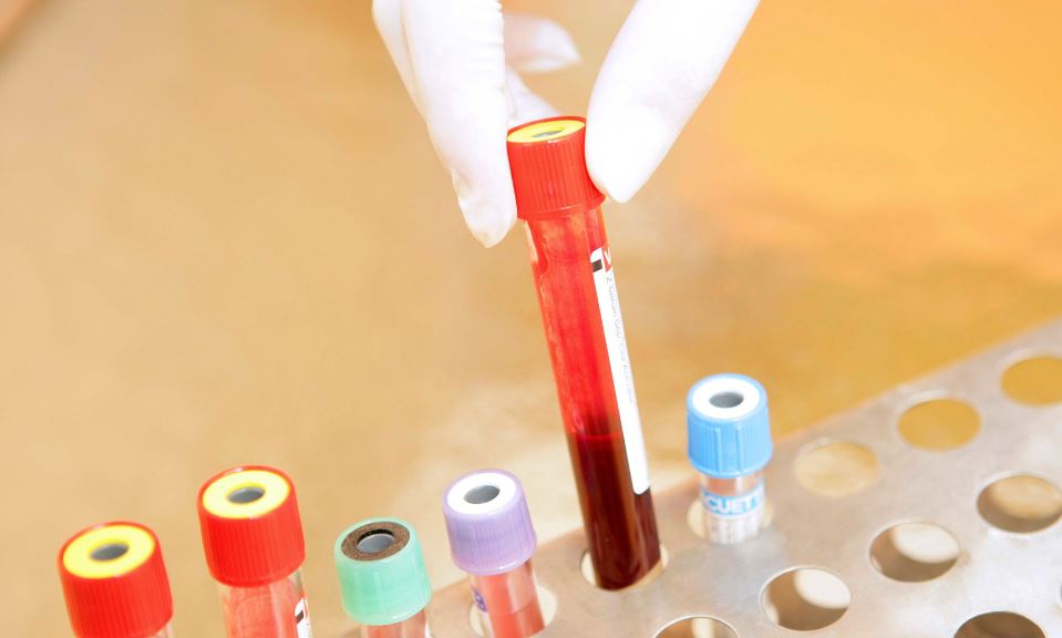 الالتهابات تظهر في تحليل الدم