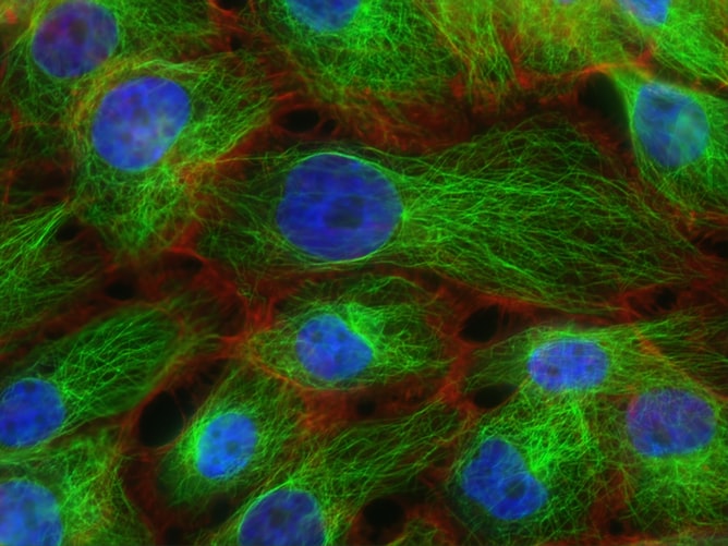 العقار الجديد يقضي على خلايا سرطان الثدي