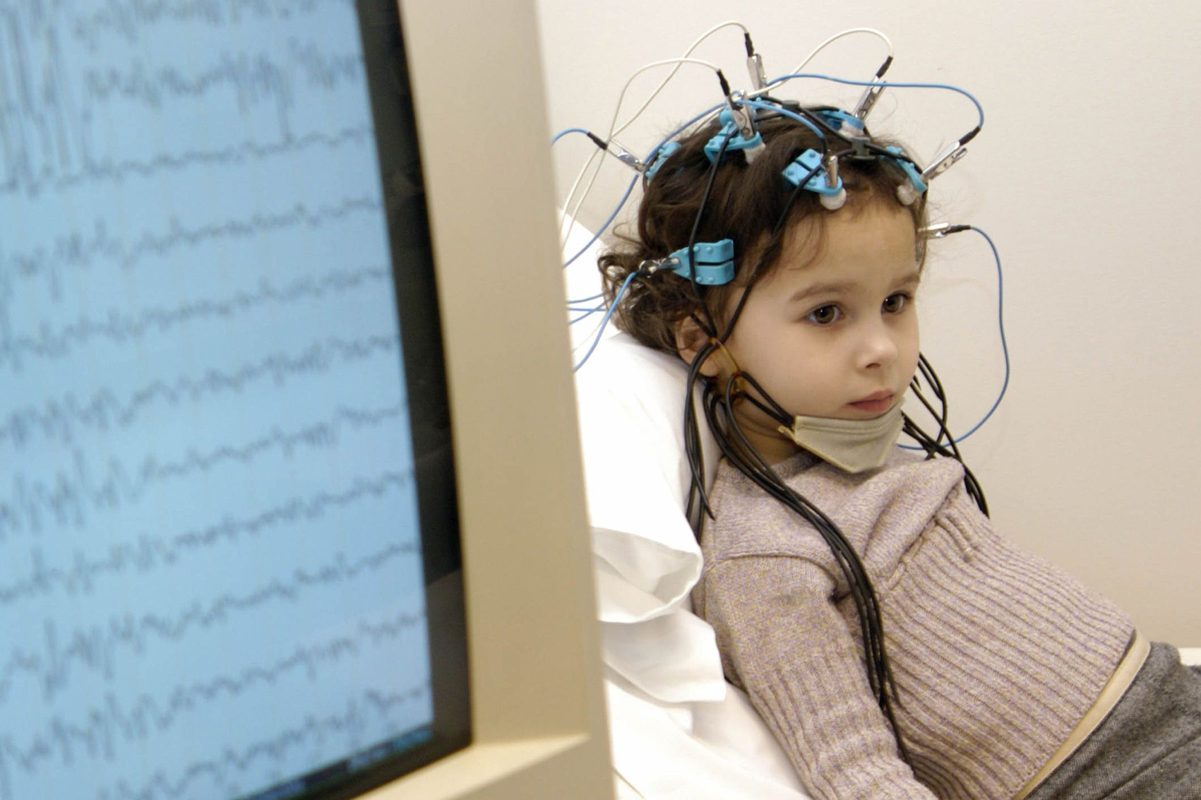 Хорошие детские эпилептологи. ЭЭГ детям. Развитие мозга. Ребенок ученый.