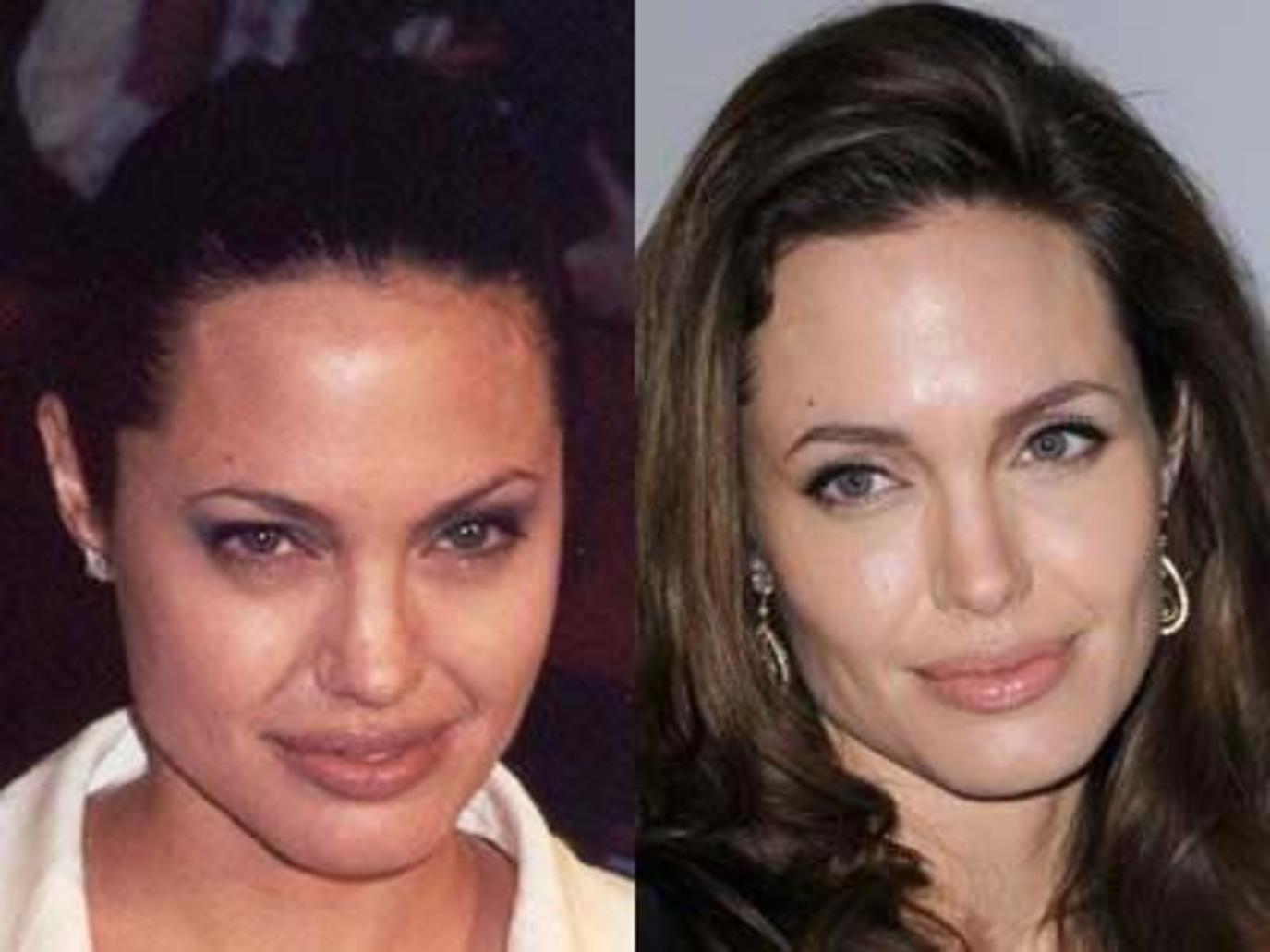 Анджелина джоли до пластики. Анжелина Джоли до пластической операции. Анджелина Джоли до и после пластики. Нос Анджелины Джоли.