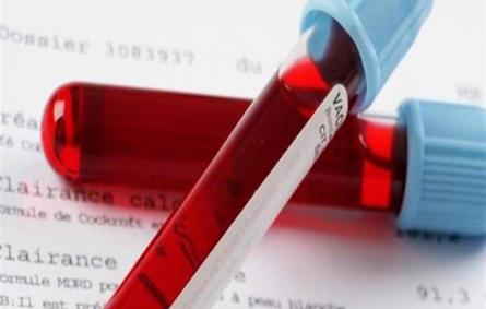 دراسة جديدة تكشف عن فصيلة دم تزيد من مخاطر الإصابة بكورونا