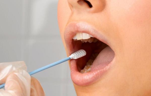 الاسنان...تأثير اضطرابات تركيبة اللعاب والعلاجات