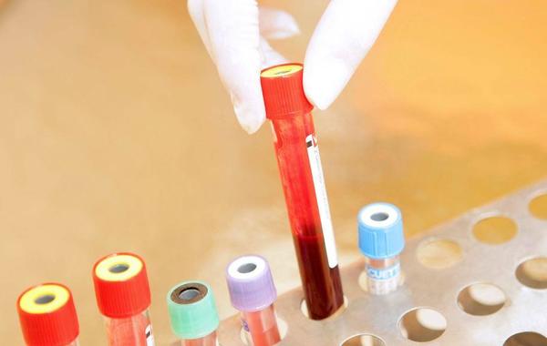 فحص للدم يكشف نمط حياة الأفراد ويتنبأ بالأمراض