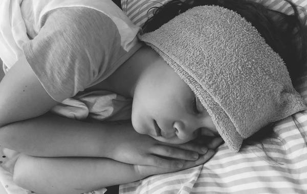 صورة لطفلة مصابة بالحمى