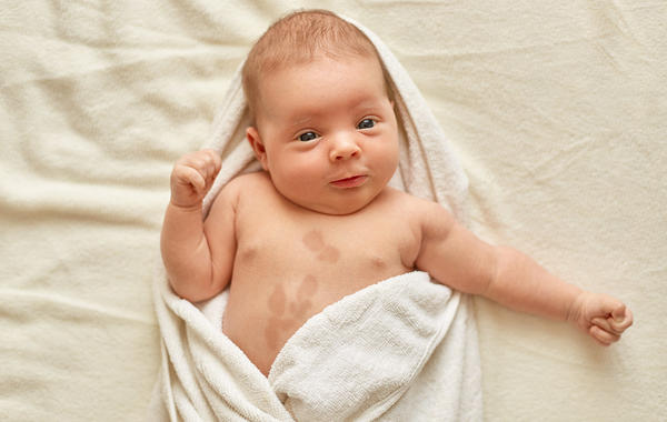 أسباب ظهور بقع بنية وحمراء على جلد الرضيع