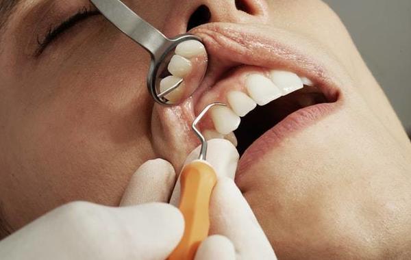 صحة الفم والأسنان أولوية