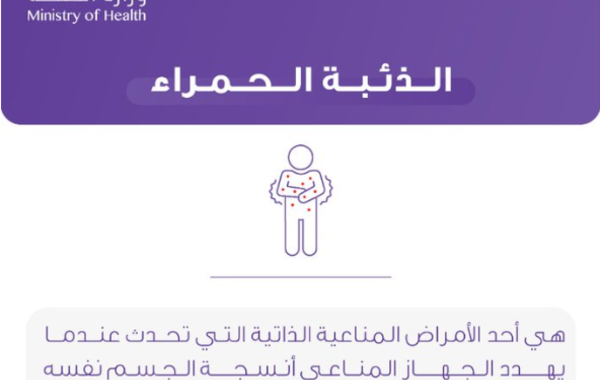 الصحة السعودية تستعرض معلومات عن الذئبة الحمراء - الصورة من حساب الصحة السعودية