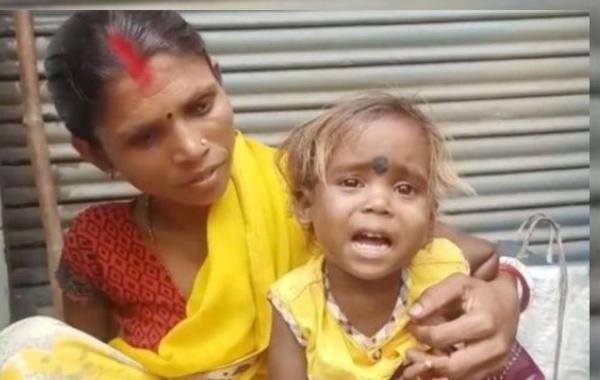 معاناة طفلة هندية ولدت بأطراف زائدة
