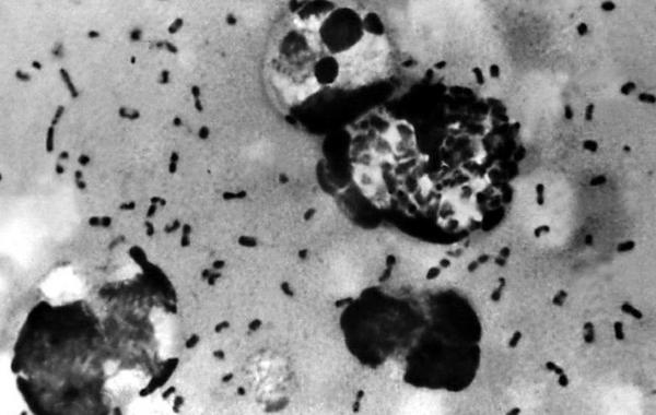 صورة البكتيريا المسببة للطاعون