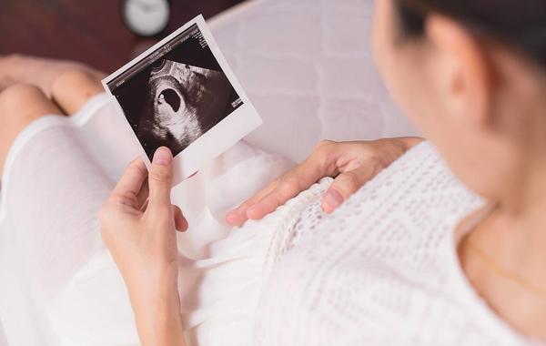 صورة لامرأة حامل تنظر إلى صور لأشعة سونار