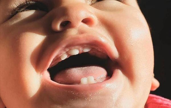 صورة لرضيع بدأت أسنانه بالظهور