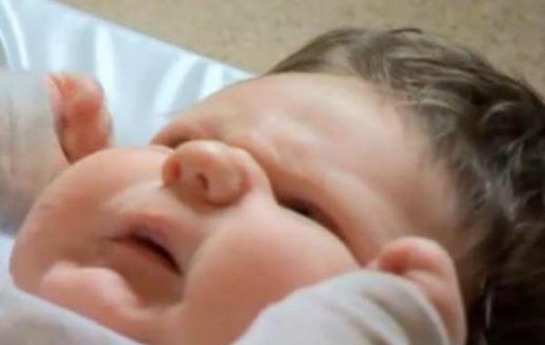 20 طبيب في ولادة الرضيع الأضخم في العالم