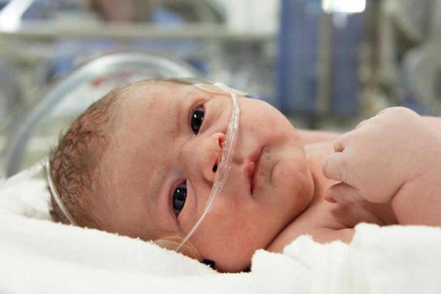 Церебральная ишемия у новорожденного 2. Фетопатия новорожденных. Транзиторное тахипноэ новорожденных. Асфиксия новорожденных. Асфиксия новорожденного легкой степени.